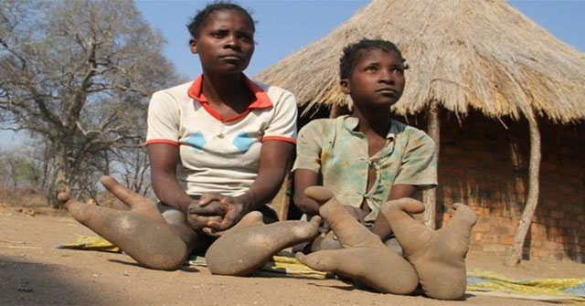 Khám Phá Bộ Lạc Vadoma: Những Người Chân Đà Điểu Kỳ Lạ Tại Zimbabwe