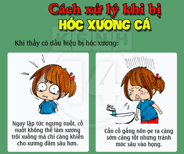 Cách xử lý khi bị hóc xương cá
